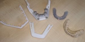 3D printed dental models and surgical guides on a table.