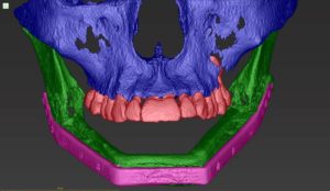 3D colored model of human jaw and teeth structure.